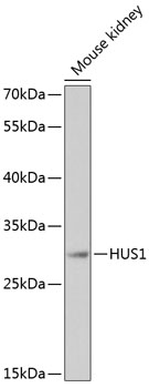 Western blot - HUS1 Polyclonal Antibody 