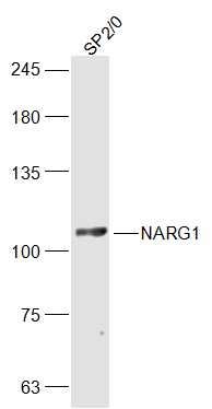 Fig1: Sample:; SP2/0 (Mouse) Lysate at 30 ug; Primary: Anti-NARG1 at 1/300 dilution; Secondary: IRDye800CW Goat Anti-Rabbit IgG at 1/20000 dilution; Predicted band size: 101 kD; Observed band size: 101 kD
