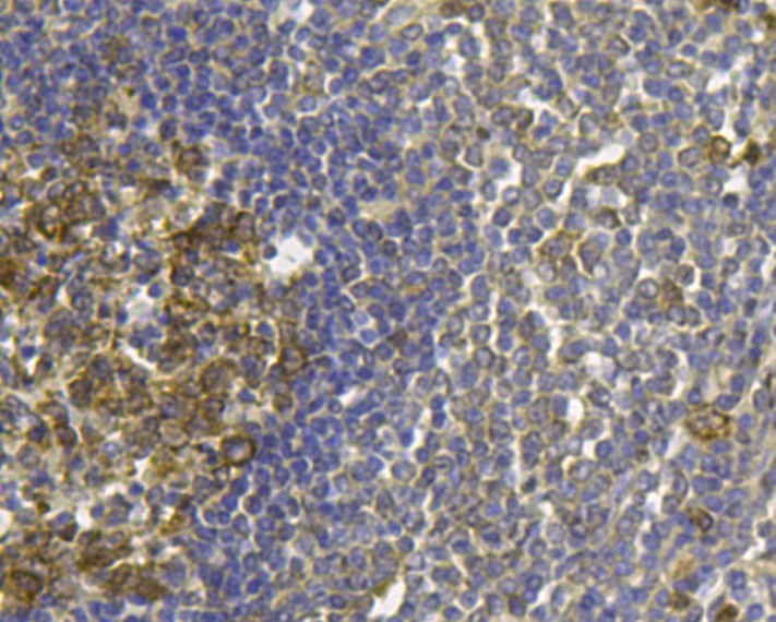 Fig4: Immunohistochemical analysis of paraffin-embedded human spleen tissue using anti-FPR1 antibody. Counter stained with hematoxylin.
