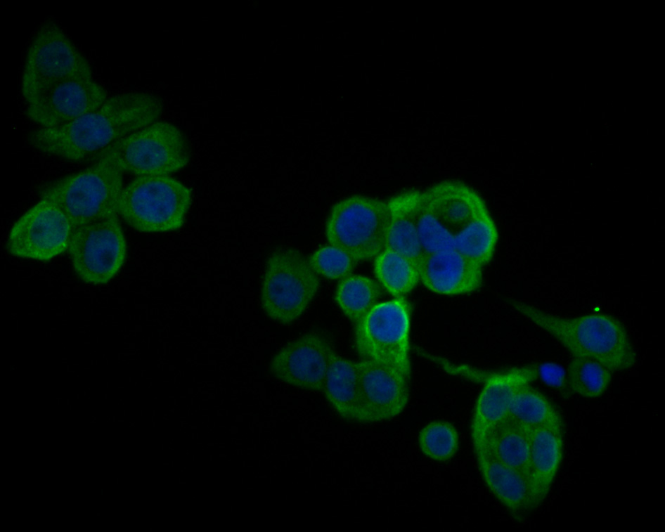 Fig2:; ICC staining of IL18 binding protein in LOVO cells (green). Formalin fixed cells were permeabilized with 0.1% Triton X-100 in TBS for 10 minutes at room temperature and blocked with 1% Blocker BSA for 15 minutes at room temperature. Cells were probed with the primary antibody ( 1/200) for 1 hour at room temperature, washed with PBS. Alexa Fluor®488 Goat anti-Rabbit IgG was used as the secondary antibody at 1/1,000 dilution. The nuclear counter stain is DAPI (blue).