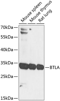 Western blot - BTLA Polyclonal Antibody 