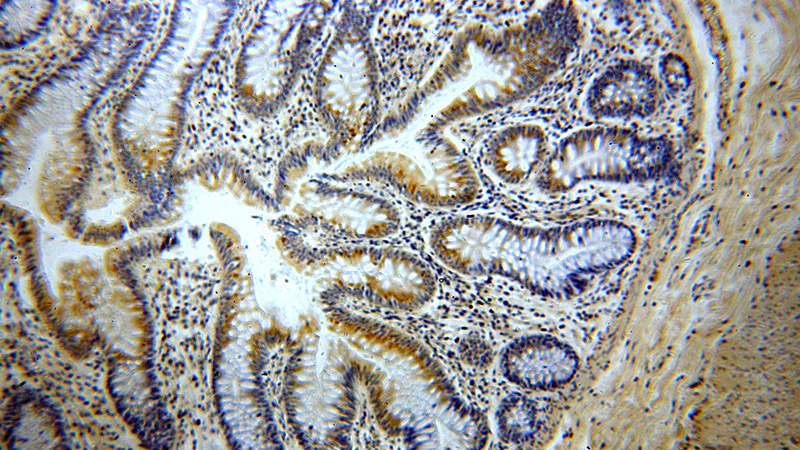 Immunohistochemical of paraffin-embedded human colon using Catalog No:108693(C20orf149 antibody) at dilution of 1:100 (under 10x lens)