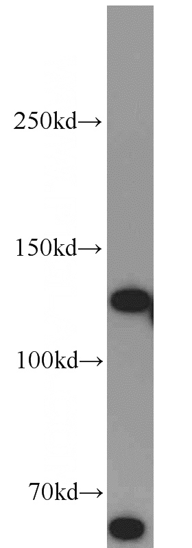 HeLa cells were subjected to SDS PAGE followed by western blot with Catalog No:114618(RBM6 antibody) at dilution of 1:300