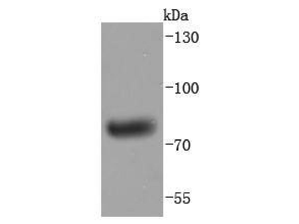 Fig1:; Western blot analysis of Human IgM on human plasma lysates. Proteins were transferred to a PVDF membrane and blocked with 5% BSA in PBS for 1 hour at room temperature. The primary antibody ( 1/500) was used in 5% BSA at room temperature for 2 hours. Goat Anti-Rabbit IgG - HRP Secondary Antibody (HA1001) at 1:200,000 dilution was used for 1 hour at room temperature.