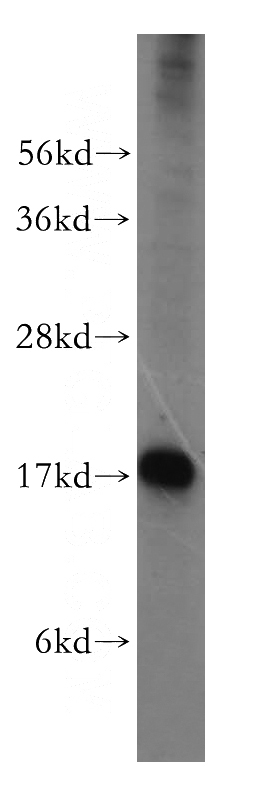 HeLa cells were subjected to SDS PAGE followed by western blot with Catalog No:116651(UBL4A antibody) at dilution of 1:400