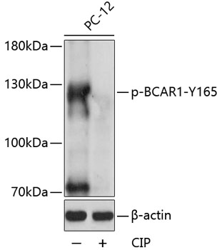 Western blot - Phospho-BCAR1-Y165 pAb 
