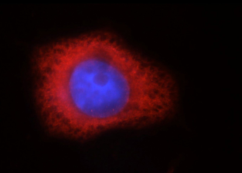 Immunofluorescent analysis of MCF-7 cells, using IGF2BP3 antibody Catalog No:111681 at 1:25 dilution and Rhodamine-labeled goat anti-rabbit IgG (red). Blue pseudocolor = DAPI (fluorescent DNA dye).