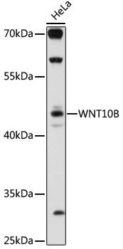 Western blot - WNT10B Polyclonal Antibody 