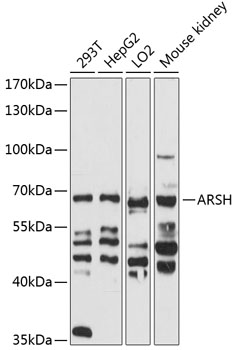 Western blot - ARSH Polyclonal Antibody 