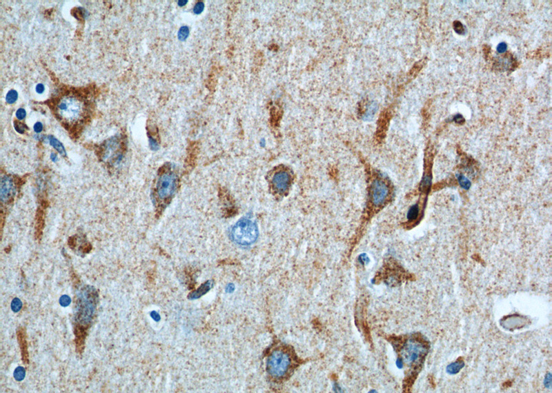 Immunohistochemistry of paraffin-embedded human brain tissue slide using Catalog No:115507(SORT1 Antibody) at dilution of 1:100 (under 40x lens).