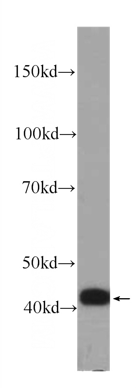 Recombinant protein were subjected to SDS PAGE followed by western blot with Catalog No:107399(IL1F5 Antibody) at dilution of 1:2000