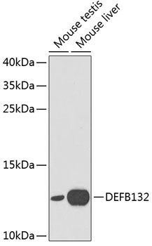 Western blot - DEFB132 Polyclonal Antibody 