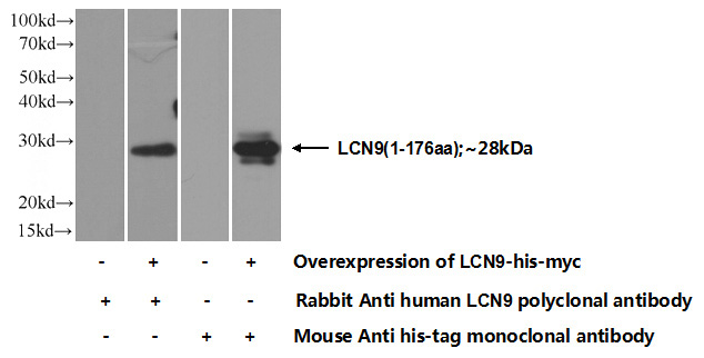 Transfected HEK-293 cells were subjected to SDS PAGE followed by western blot with Catalog No:112175(LCN9 Antibody) at dilution of 1:700