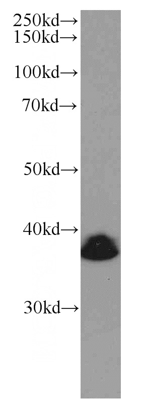 U-937 cells were subjected to SDS PAGE followed by western blot with Catalog No:107019(BMI1 Antibody) at dilution of 1:1000
