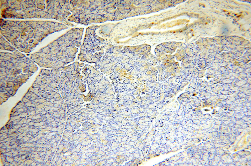 Immunohistochemical of paraffin-embedded human pancreas using Catalog No:107825(ACAD10 antibody) at dilution of 1:100 (under 10x lens)