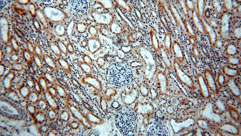 Immunohistochemical of paraffin-embedded human kidney using Catalog No:108187(FLJ10357 antibody) at dilution of 1:50 (under 10x lens)