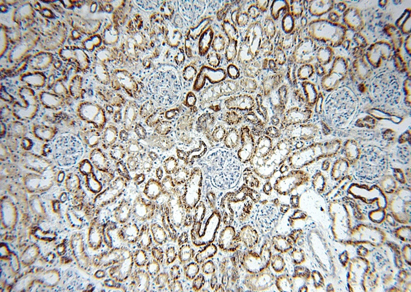 Immunohistochemical of paraffin-embedded human kidney using Catalog No:107721(ACADS antibody) at dilution of 1:100 (under 10x lens)