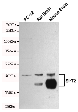 Western blot detection of SirT2 in PC-12, Rat Brain and Mouse Brain cell lysates using SirT2 mouse mAb (1:1000 diluted). Predicted band size: 39,43KDa. Observed band size:39,43KDa.