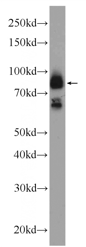 mouse brain tissue were subjected to SDS PAGE followed by western blot with Catalog No:112315(LRCH2 Antibody) at dilution of 1:1500