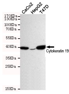 Western blot detection of Cytokeratin 19 in CaCo2,HepG2 and T-47D cell lysates using Cytokeratin 19 mouse mAb (dilution 1:500).Predicted band size:41KDa.Observed band size:41KDa.