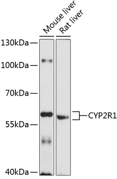 Western blot - CYP2R1 Polyclonal Antibody 