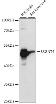 Western blot - B3GNT4 Polyclonal Antibody 