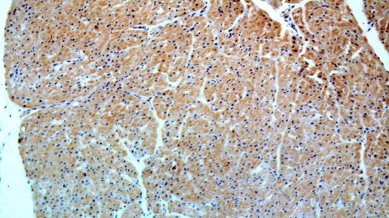 Immunohistochemical of paraffin-embedded human heart using Catalog No:113051(ND2 antibody) at dilution of 1:50 (under 10x lens)