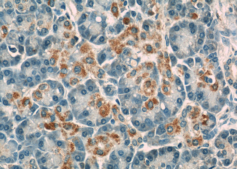 Immunohistochemistry of paraffin-embedded human pancreas slide using Catalog No:108880(CASP9 Antibody) at dilution of 1:50