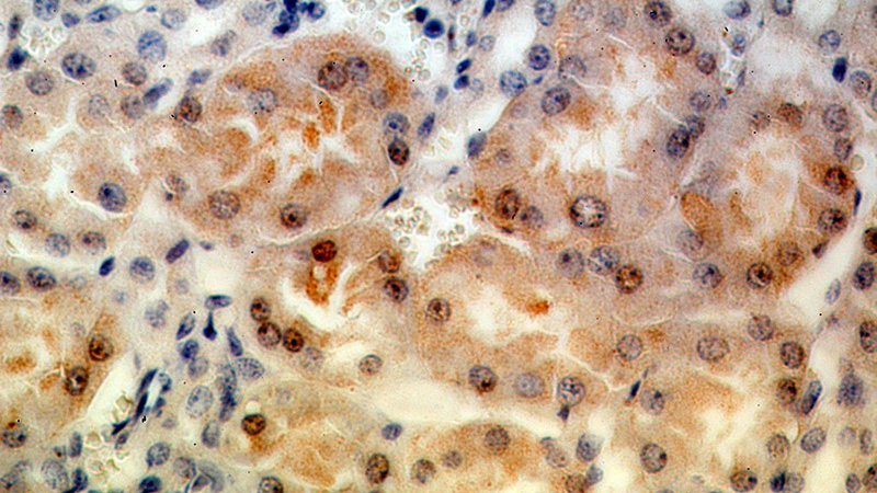 Immunohistochemical of paraffin-embedded human kidney using Catalog No:112491(MAST3 antibody) at dilution of 1:100 (under 40x lens)