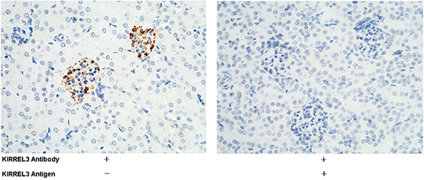 KIRREL3 / NEPH2 Antibody, Rabbit PAb, Antigen Affinity Purified, Immunohistochemistry
