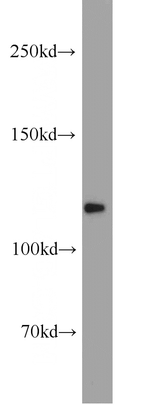 mouse brain tissue were subjected to SDS PAGE followed by western blot with Catalog No:113113(NELL2 antibody) at dilution of 1:1000