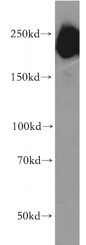 human brain tissue were subjected to SDS PAGE followed by western blot with Catalog No:110043(DocK3; MocA antibody) at dilution of 1:500