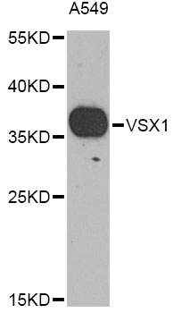 Western blot - VSX1 Polyclonal Antibody 