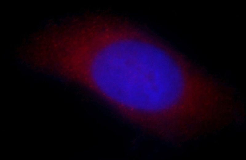Immunofluorescent analysis of Hela cells, using ARFIP2 antibody Catalog No:108254 at 1:25 dilution and Rhodamine-labeled goat anti-rabbit IgG (red). Blue pseudocolor = DAPI (fluorescent DNA dye).