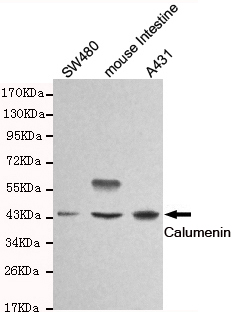 Western blot detection of Calumenin in SW480,mouse intestine and A431 cell lysates and using Calumenin mouse mAb (1:1000 diluted).Predicted band size: 37KDa.Observed band size:45KDa.