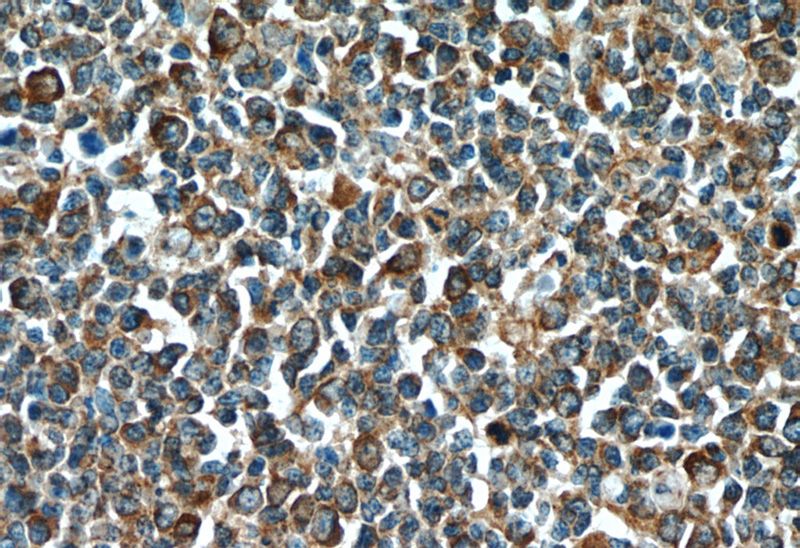 Immunohistochemistry of paraffin-embedded human tonsillitis slide using Catalog No:108670(C15orf53 Antibody) at dilution of 1:50 (under 40x lens)