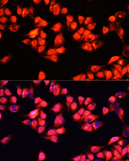 Immunofluorescence - ADRA1A Polyclonal Antibody 