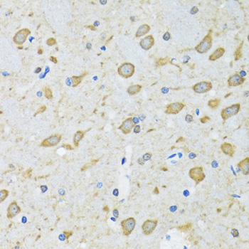 Immunohistochemistry - ATG7 Polyclonal Antibody. Immunohistochemistry of paraffin-embedded mouse brain using ATG7 antibody at dilution of 1:100 (40x lens).