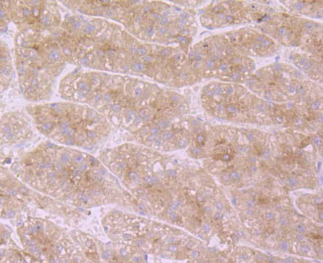 Fig2: Immunohistochemical analysis of paraffin-embedded human liver tissue using anti-APOC3 antibody. Counter stained with hematoxylin.