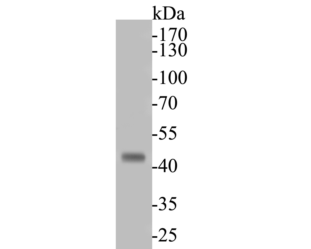 Fig1: Western blot analysis of KCNK18 on rat spinal cord tissue lysates. Proteins were transferred to a PVDF membrane and blocked with 5% BSA in PBS for 1 hour at room temperature. The primary antibody ( 1/200) was used in 5% BSA at room temperature for 2 hours. Goat Anti-Rabbit IgG - HRP Secondary Antibody (HA1001) at 1:5,000 dilution was used for 1 hour at room temperature.