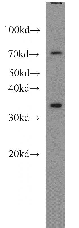 HeLa cells were subjected to SDS PAGE followed by western blot with Catalog No:111527(HOXA11 antibody) at dilution of 1:1000