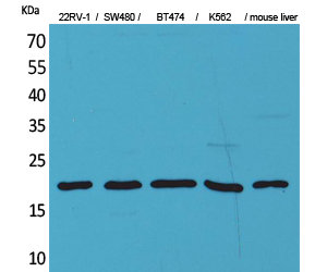 Western Blot analysis of 22RV-1, SW480, BT474, K562, mouse liver cells using VEGF-A Polyclonal Antibody. Antibody was diluted at 1:500. Secondary antibody was diluted at 1:20000