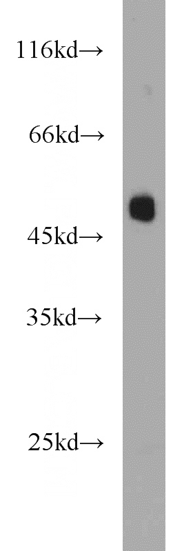human placenta tissue were subjected to SDS PAGE followed by western blot with Catalog No:113827(phospho(409/410)-TDP43 antibody) at dilution of 1:1000
