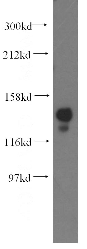 mouse testis tissue were subjected to SDS PAGE followed by western blot with Catalog No:112958(NASP antibody) at dilution of 1:1000