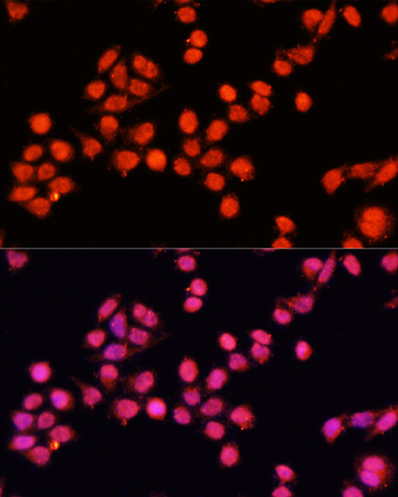 Immunofluorescence - SLC24A5 Polyclonal Antibody 