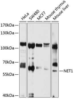 Western blot - NET1 Polyclonal Antibody 