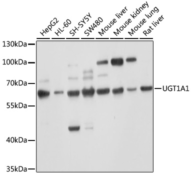Western blot - UGT1A1 Polyclonal Antibody 