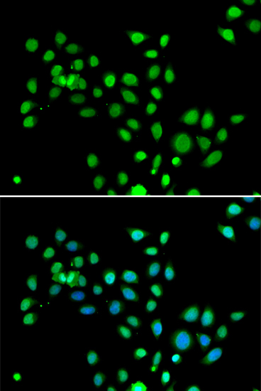 Immunofluorescence - mH2A1 Polyclonal Antibody 