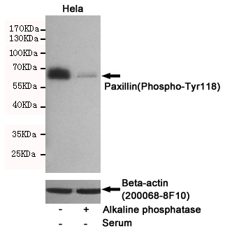 Western blot detection of Paxillin(Phospho-Tyr118) in serum-starved A549 cells untreated or treated with Alkaline phosphatase using Paxillin(Phospho-Tyr118) Rabbit pAb (dilution 1:1000, upper) or u03b2-Actin Mouse mAb (200068-8F10, lower)).Predicted band size:68kDa.Observed band size:68kDa.
