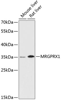 Western blot - MRGPRX1 Polyclonal Antibody 